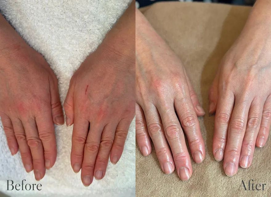 極上ハンドリプロ施術結果