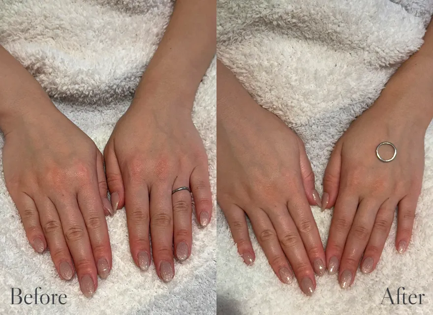 極上ハンドリプロ施術結果