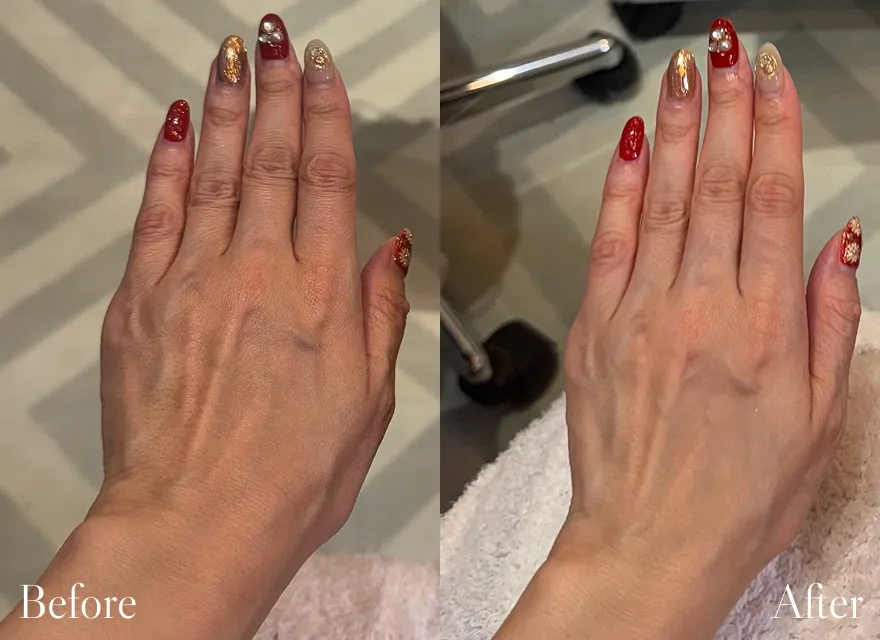 極上ハンドリプロ施術結果