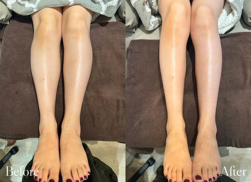 極上ハンドリプロ施術結果