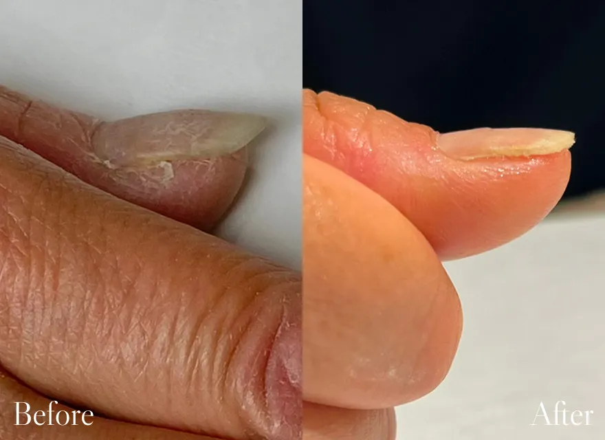 極上ハンドリプロ施術結果