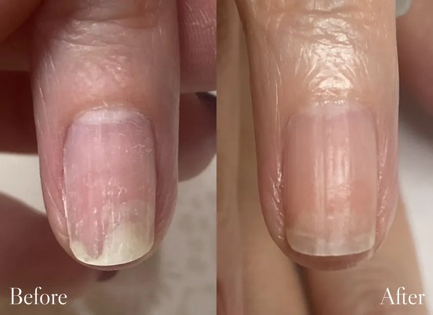 極上ハンドリプロ施術結果