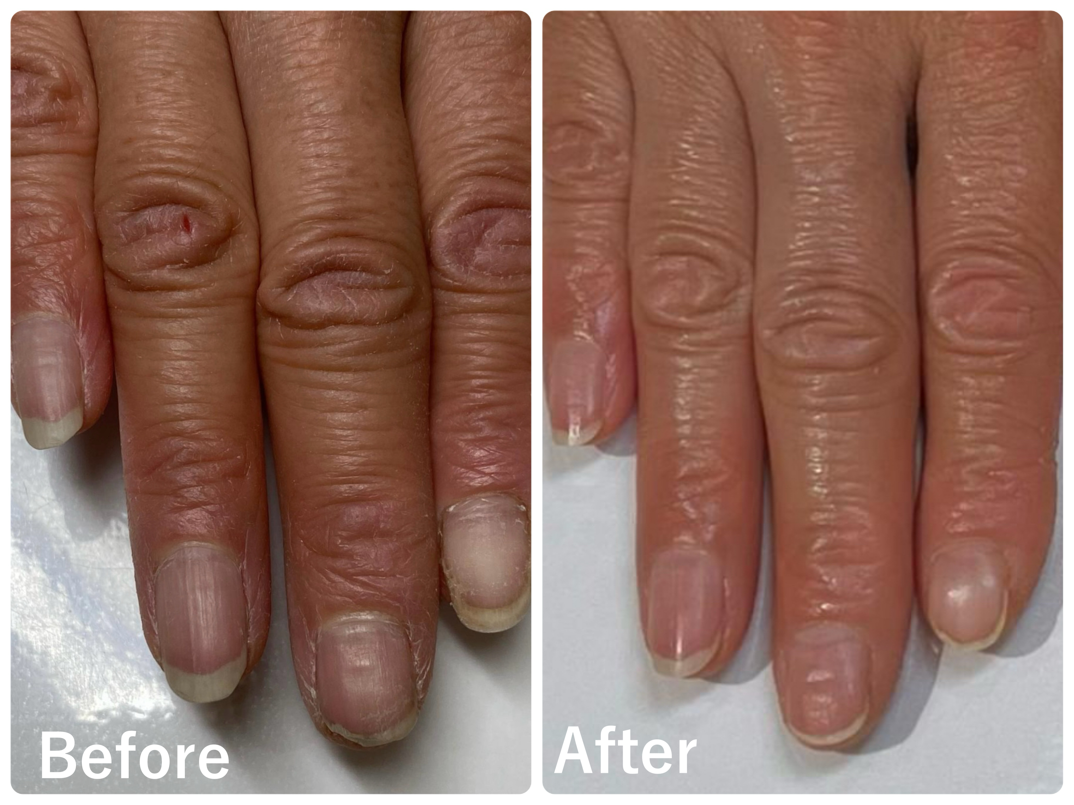 50代女性の極上ハンドリプロコース結果写真